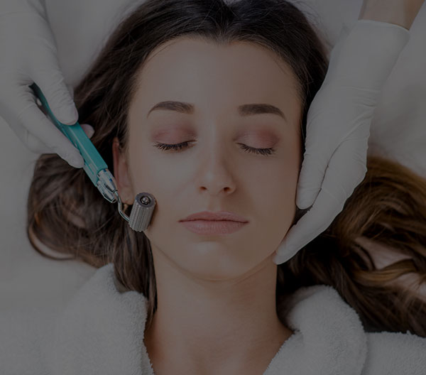 What are the Benefits of Microneedling?
