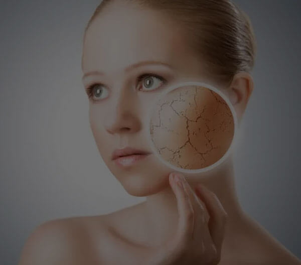 Dermatologists’ Top Tips for Relieving Dry Skin