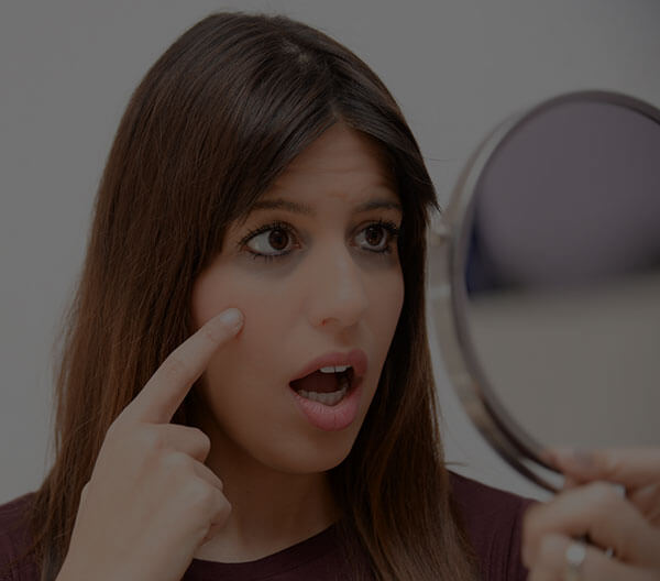 under-eye-dark-circles-treatment-in-hyderabad